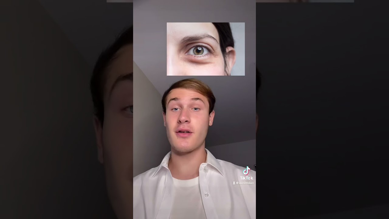 Neuroscientist's Perspective: Are Contact Lenses Good for Our Eyes? Insights from Dr. Jeffrey Goldberg, Ophthalmologist